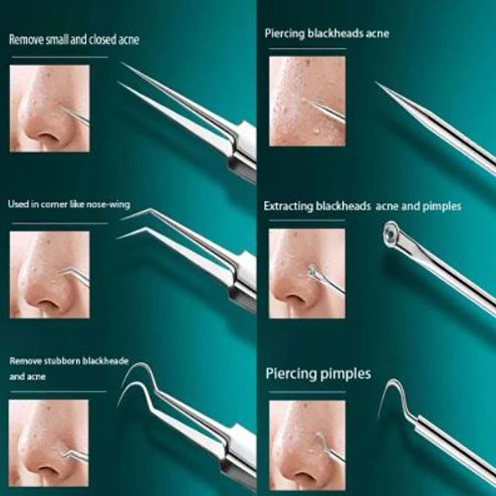 Ultra-fine Acne Needle Tool Set